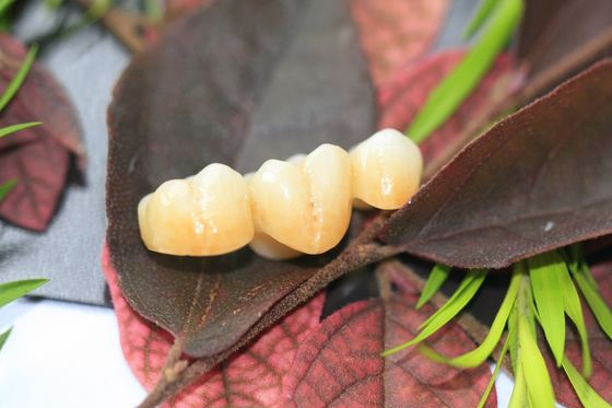 Corona dentaria di biossido di zirconio monolitico dentario del laboratorio di progettazione per i denti posteriori dei molari