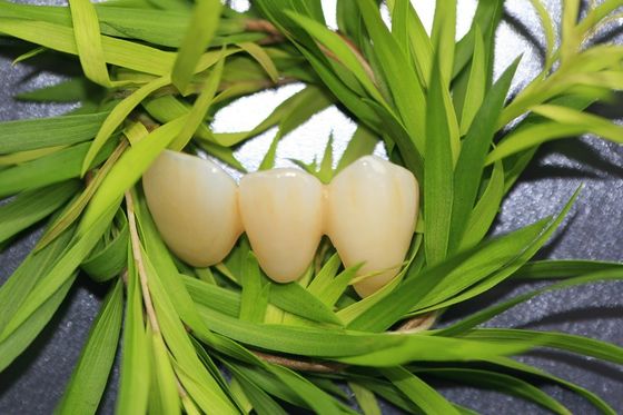 Corona dentaria naturale di EMAX