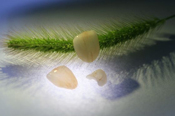Tutta la corona ceramica della porcellana di EMAX