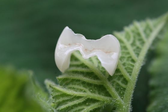 Corona dentaria artificiale estetica dell'intarsio e del parte sovrapposto in rilievo EMAX