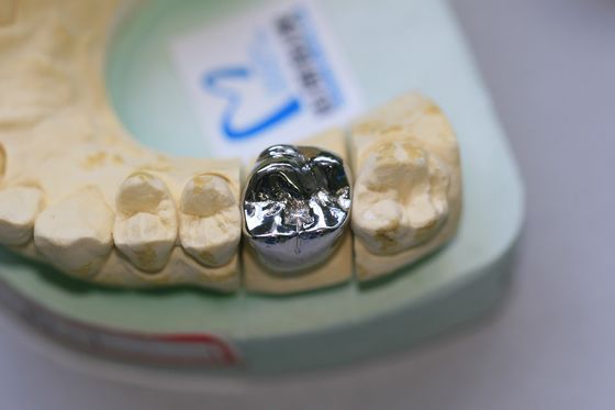 Il metallo base fuso pieno unisce in lega la corona dentaria