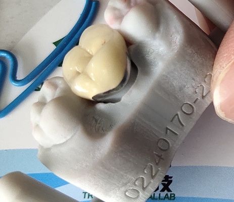 Porcellana dentaria della corona di camma PFM del prodotto cad del laboratorio fusa a metallo