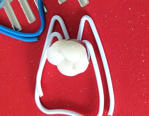 Corona dentaria della corona 3D del laboratorio PFM del ponte dentario di stampa