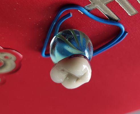 Porcellana dentaria della corona di camma PFM del prodotto cad del laboratorio fusa a metallo