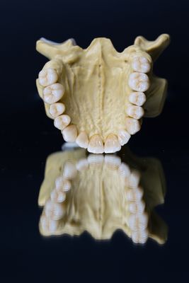 Estetica dentaria delle stelle della corona 5 del laboratorio di biossido di zirconio dentario della porcellana