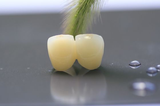 corona dentaria del laboratorio della struttura PFM della stampa 3D per odontoiatria