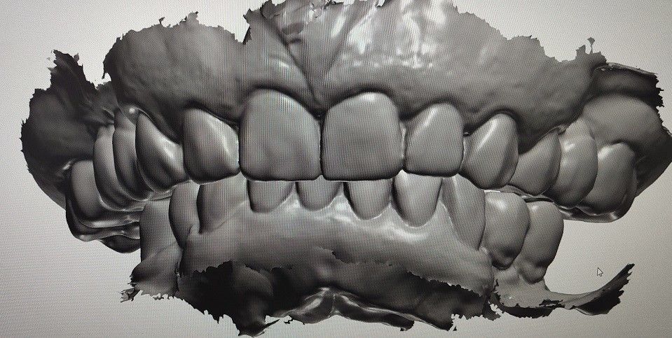 Denti del modello del visualizzatore digitale di progettazione di camma di cad altri prodotti dentari
