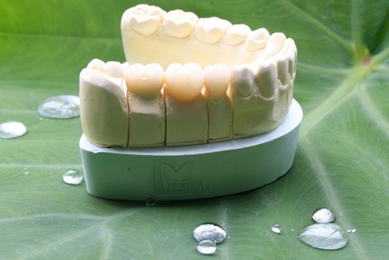 Corona dentaria di grande di biocompatibilità biossido di zirconio pieno di contorno per il laboratorio dentario