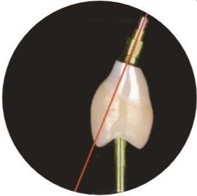 Il CSA naturale ha inclinato il Manica che della vite gli impianti dentari incoronano