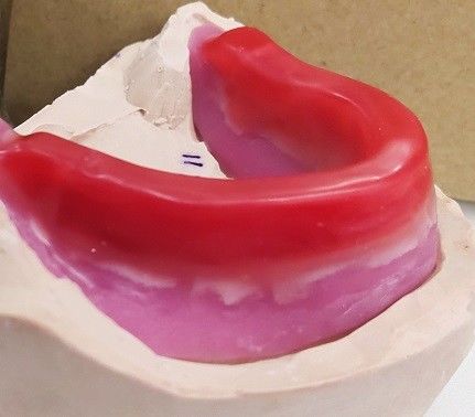 Blocchetti record dentari di Trushine per le protesi dentarie piene finali