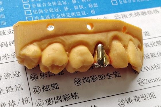 Corona dentaria dell'alto metallo pieno nobile dell'oro