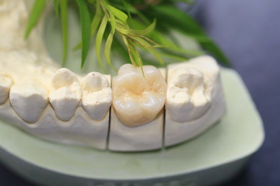 Corona dentaria di biossido di zirconio monolitico dentario del laboratorio di progettazione per i denti posteriori dei molari